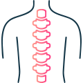 Spine Surgery