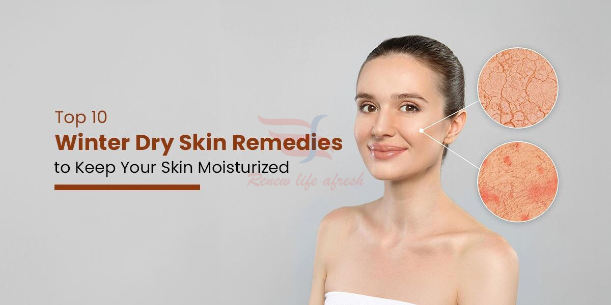 Top 10 Winter Dry Skin Remedies to Keep Your Skin Moisturized