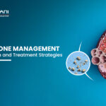 Kidney Stone Management: Best Prevention and Treatment Strategies